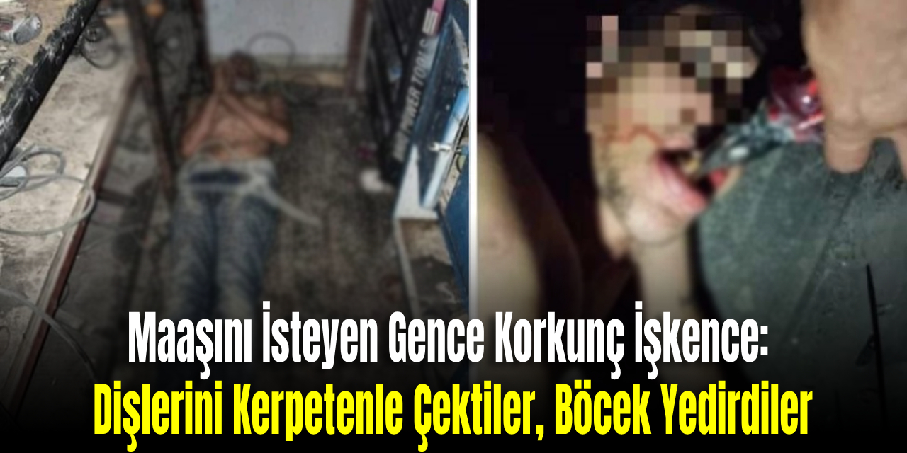 Maaşını İsteyen Gence Korkunç İşkence Dişlerini Kerpetenle Çektiler, Böcek Yedirdiler (1)