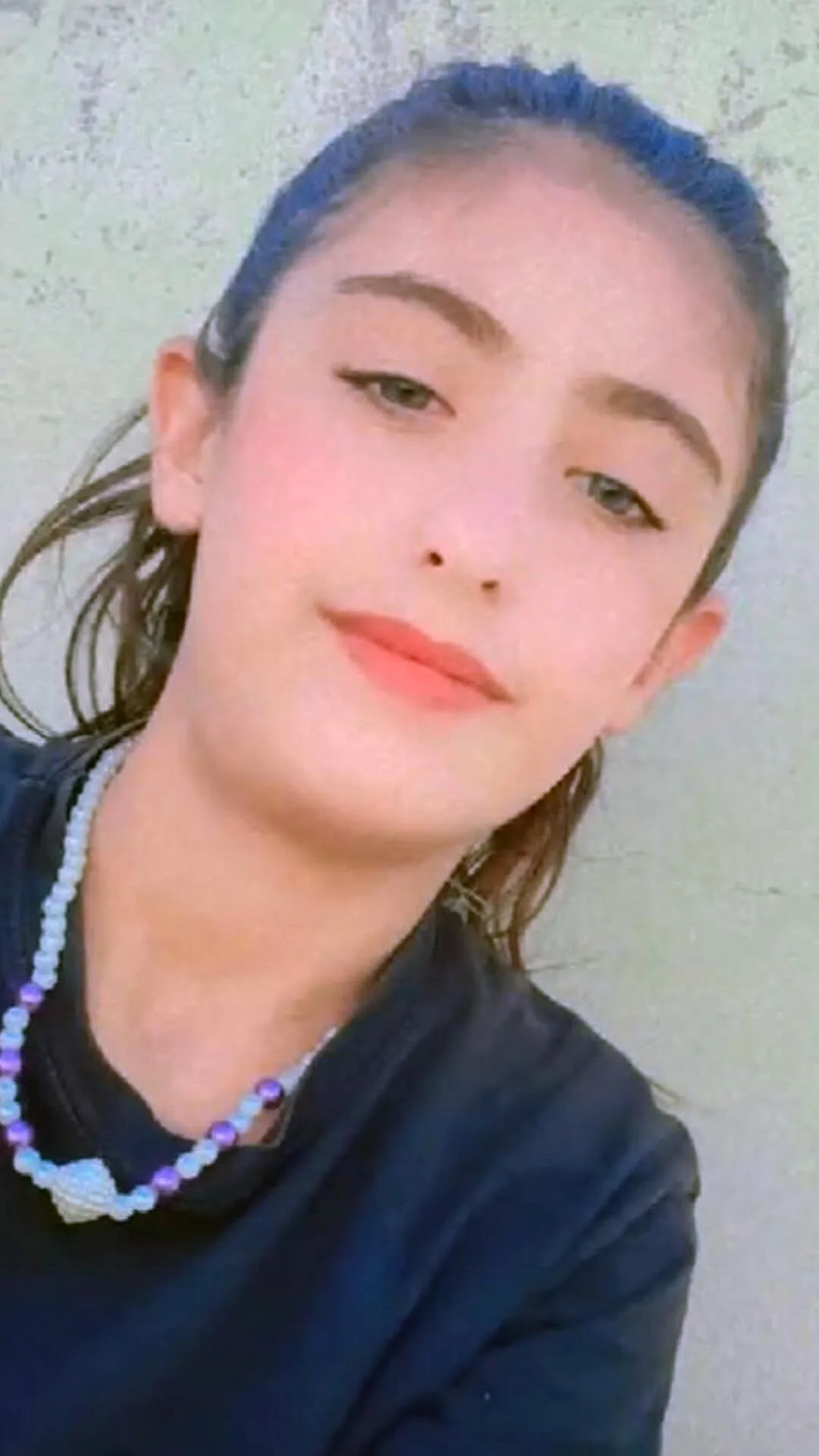 Silahla Vurulan 14 Yasindaki Kiz Cocugu Oldu 3