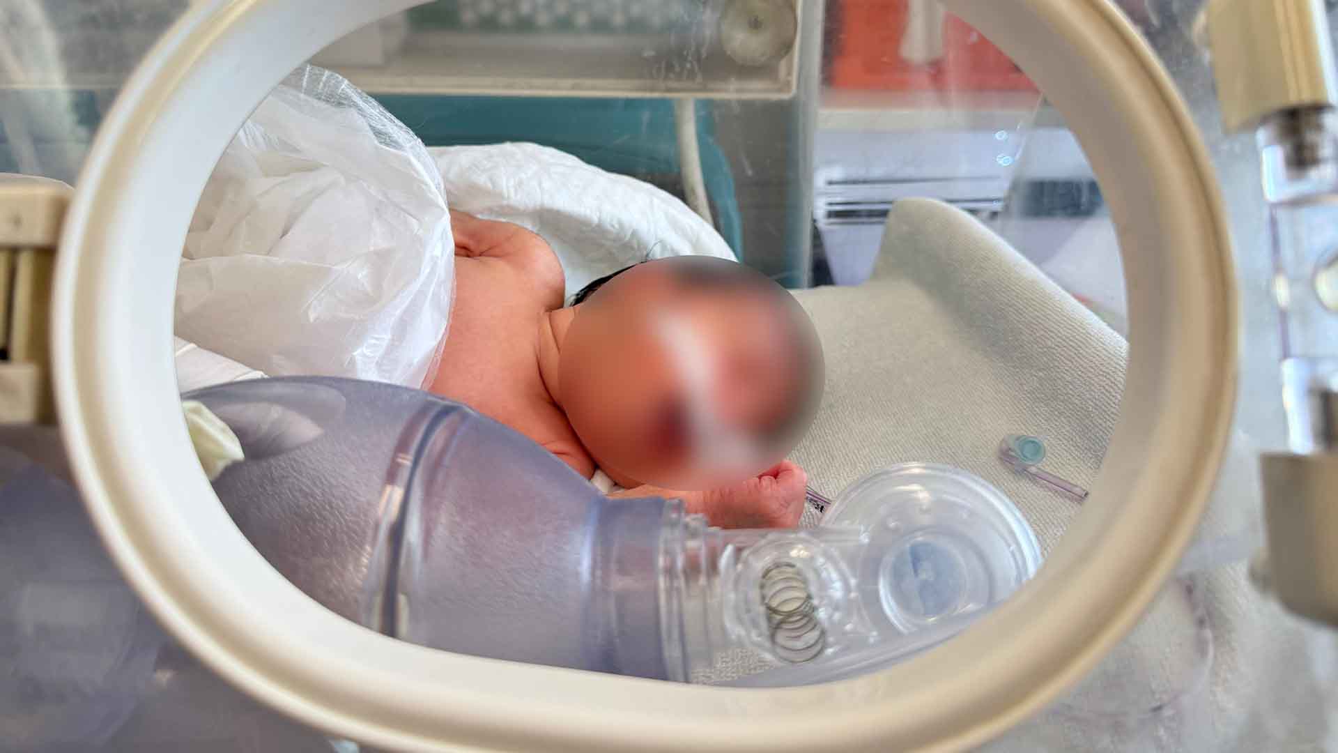 Ağrı’da Prematüre Doğan Zeynep Bebek, Uçak Ambulansla Gaziantep’e Sevk Edildi