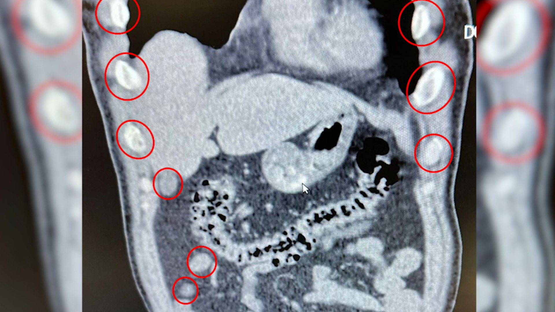 Haber Kapak Şablon (32)-24