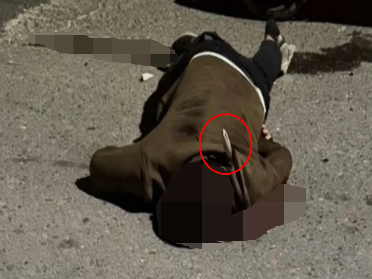 Sokakta Ugradigi Bicakli Saldirida Oldu 1