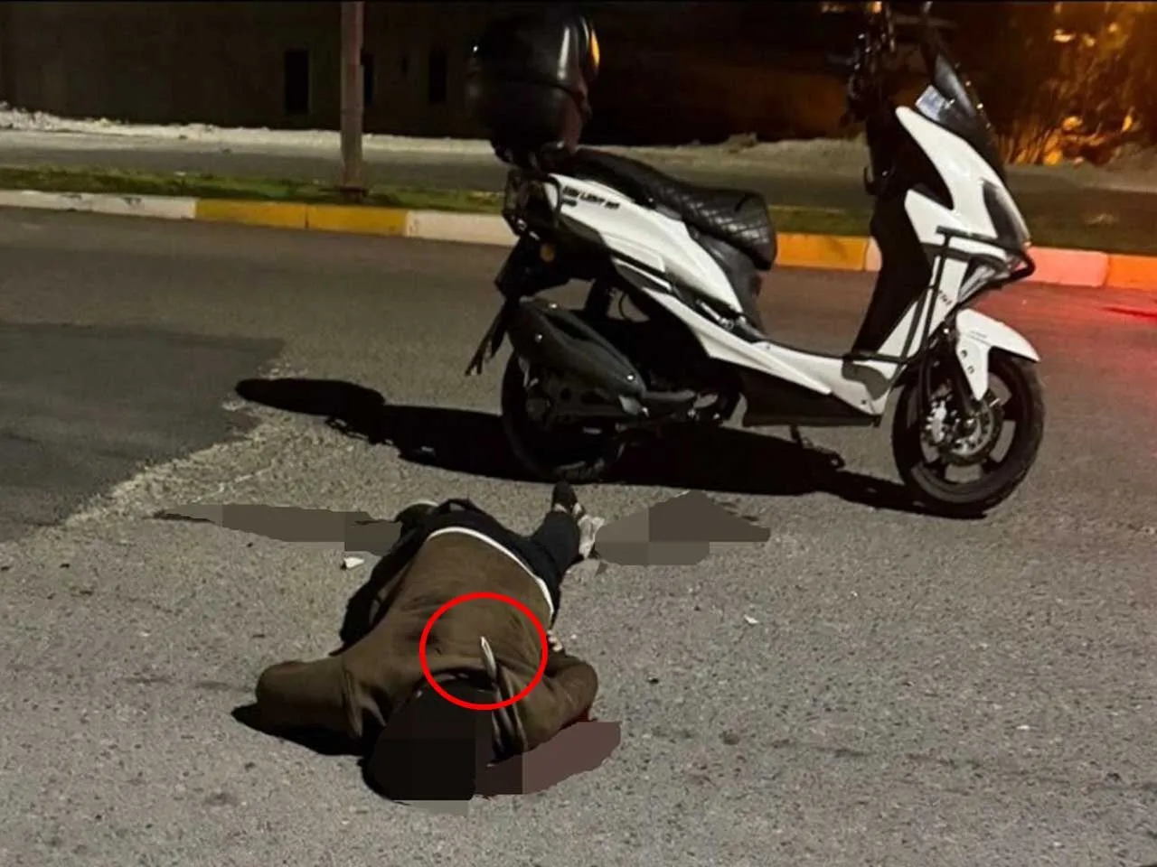 Sokakta Ugradigi Bicakli Saldirida Oldu 2