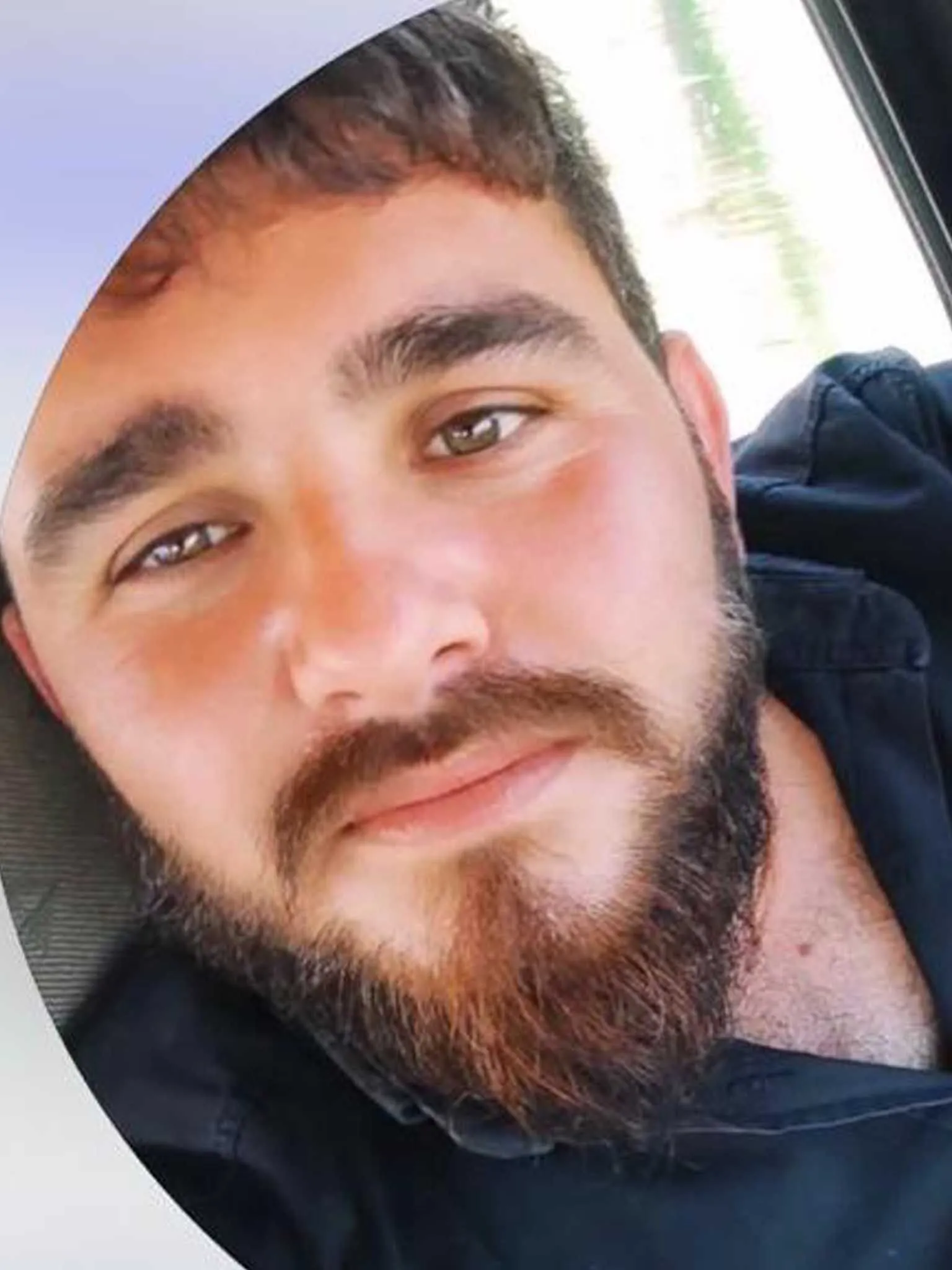 Tarim Iscilerini Tasiyan Minibusun Sarampole Yuvarlandigi Kazada Olu Sayisi 7Ye Cikti 5