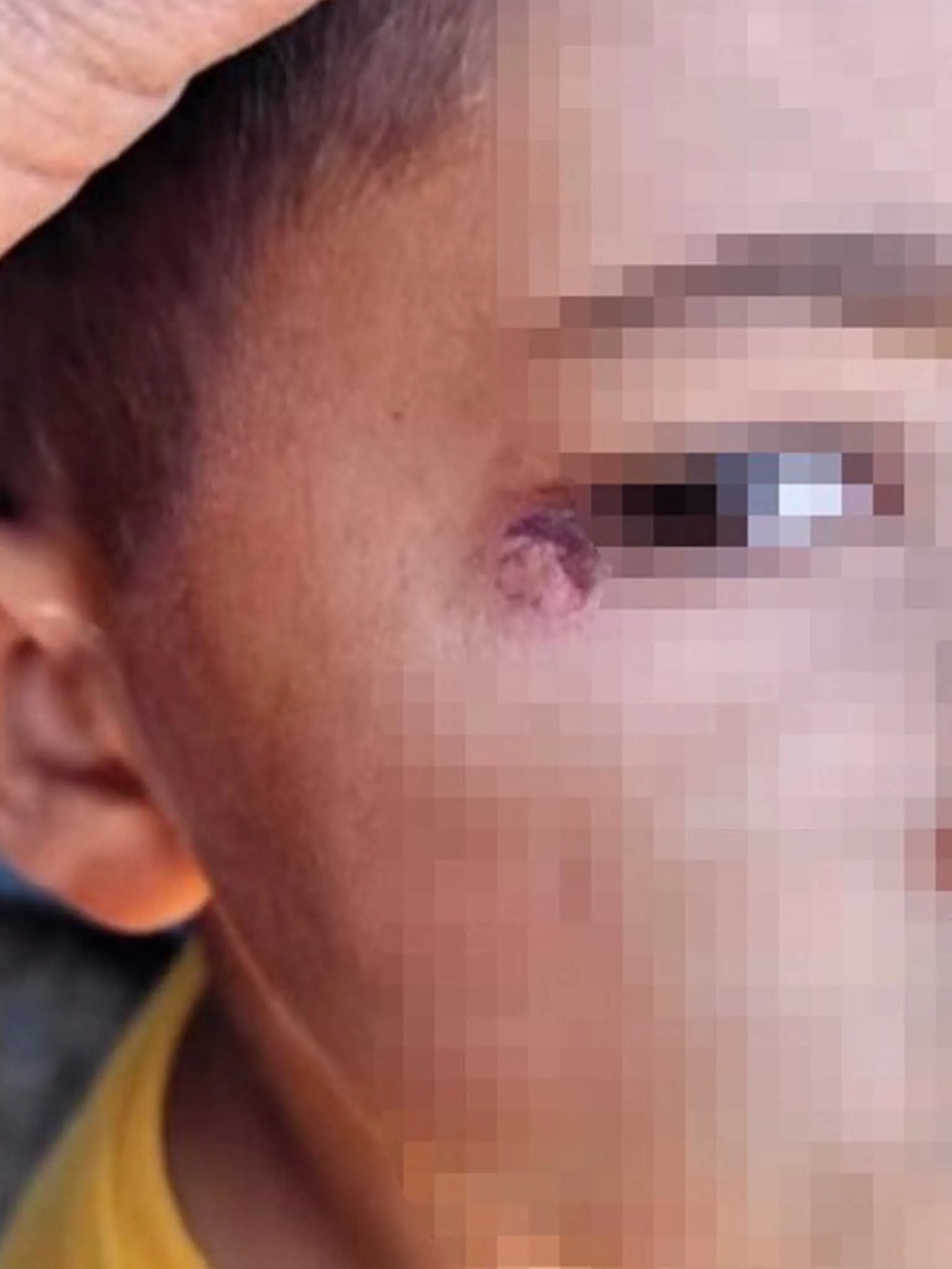 Temizlikci 2Nci Sinif Ogrencisinin Yuzunde Sigara Sondurdu 1