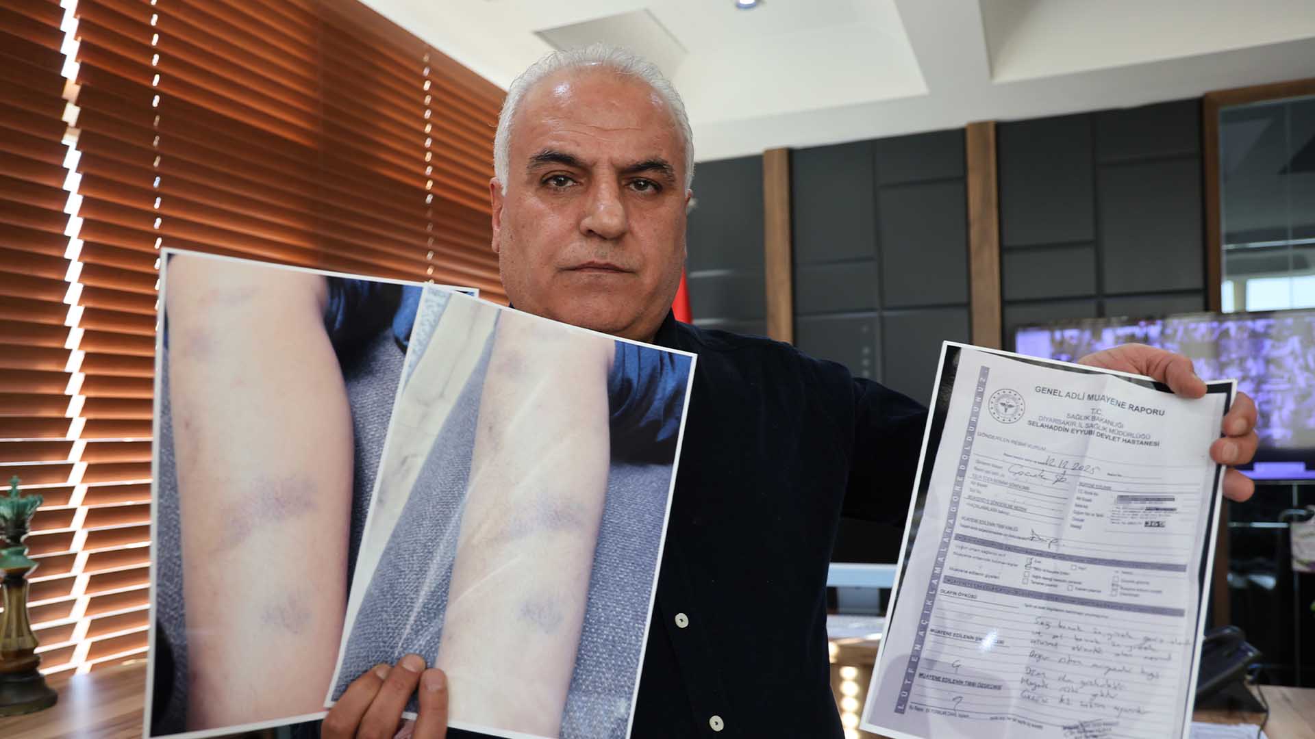 Diyarbakır’da Özel Okulda Darp Iddiası, 8 Yaşındaki Çocuk Için Suç Duyurusu 1