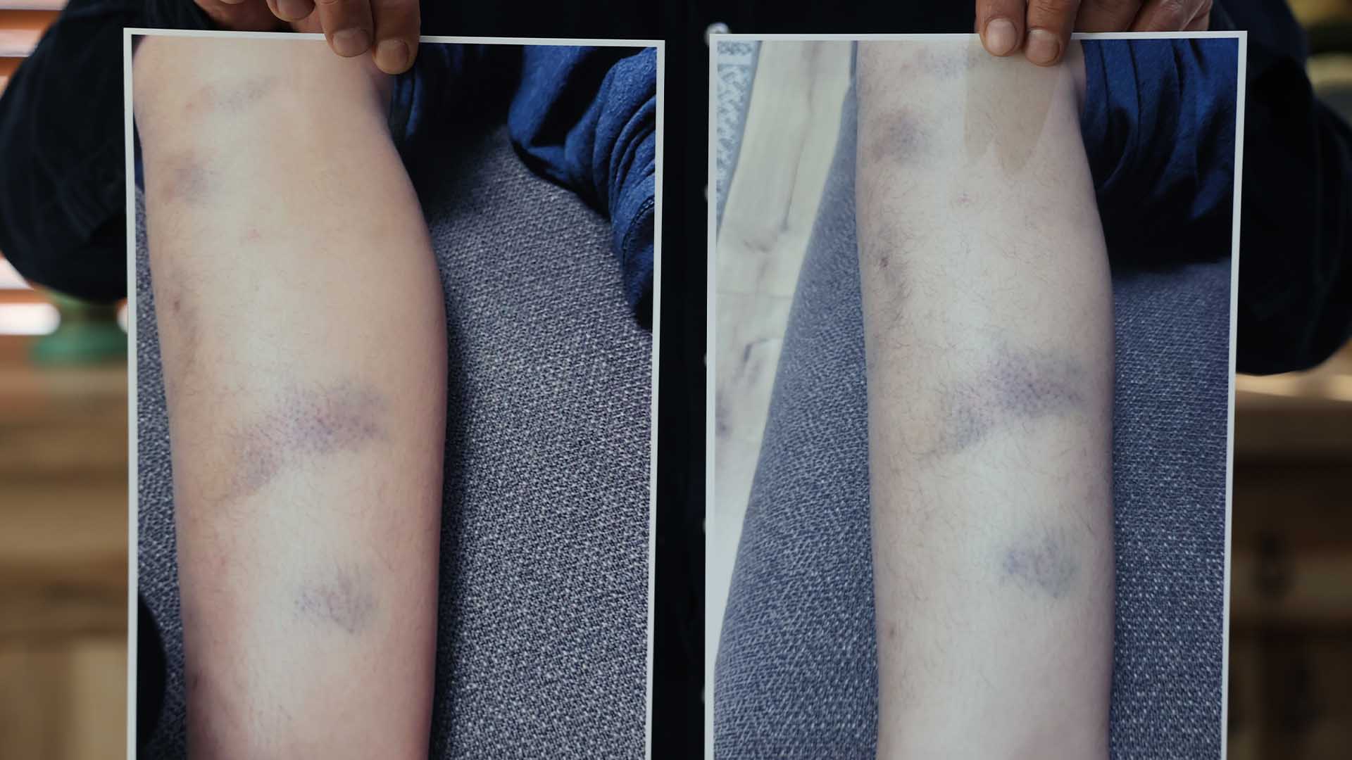 Diyarbakır’da Özel Okulda Darp Iddiası, 8 Yaşındaki Çocuk Için Suç Duyurusu 2