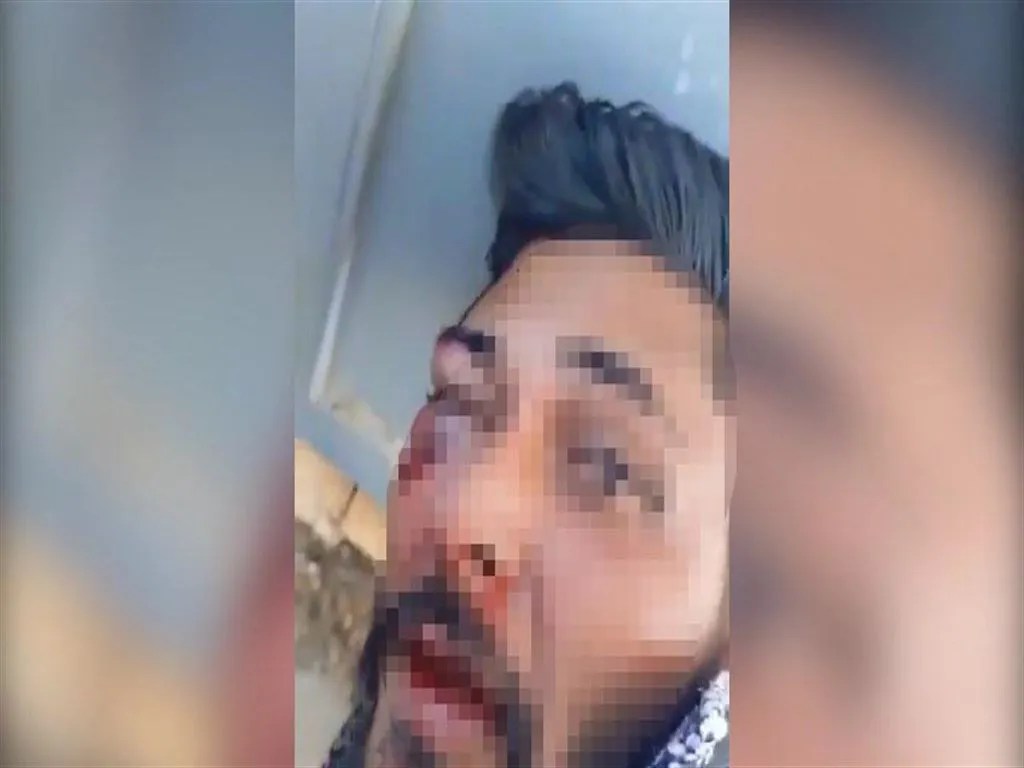 Taciz Suphelisi Sokakta Dovuldu Jandarmaya Teslim Edildi 2