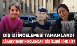 Narin Güran Cinayetinde Adli Tıp'ın Diş İzi Soruşturması Tamamlandı: Ağabey Enes'in kolundaki Diş İzleri Kimin?