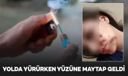 Genç Kız Yoldan Geçerken Maytapla Yaralandı