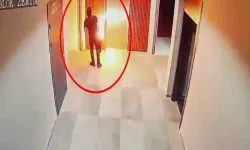 Dehşet Anı! Elektrikli Skuter Bataryası Elinde Patladı, 3 Parmağı Yanık