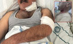 Beslediği atın saldırısına uğrayan şahıs ağır yaralandı