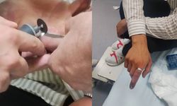 Bitlis'te Parmağına Sıkışan Yüzüğü İtfaiye Ekipleri Kesti