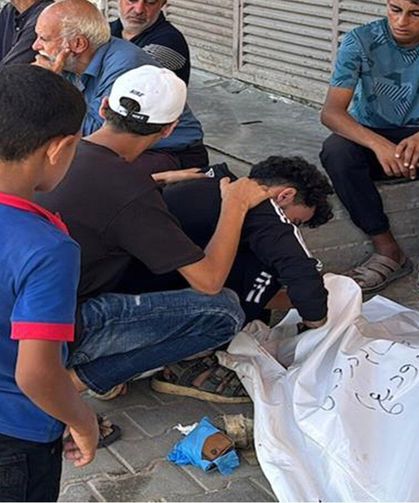 Gazze'de Can Kaybı Artıyor: Şehit Sayısı 73 Bin 382'ye Yükseldi