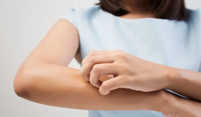 Bitlisliler uyuz hastalığına dikkat! Vakalar artıyor, doktorlar uyarıyor… Geceleri bunu yaşıyorsanız hemen doktora gidin