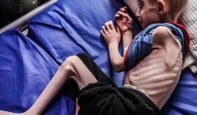 Gazze’de Açlık Alarmı: 2 Ayda 58 Kayıp, Yüzlerce Düşük Vakası