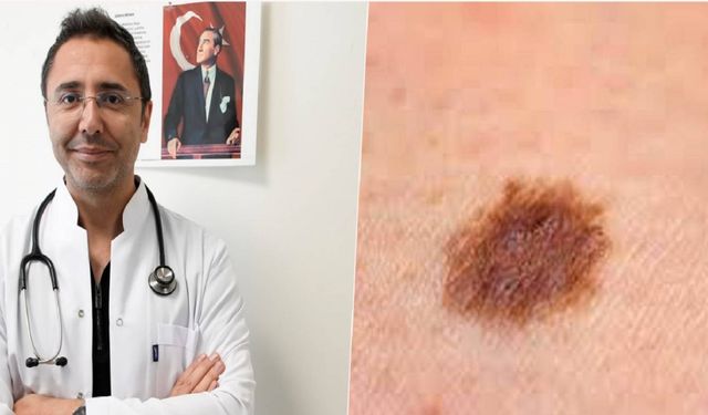 Uzman Doktordan Cilt Kanseri Uyarısı