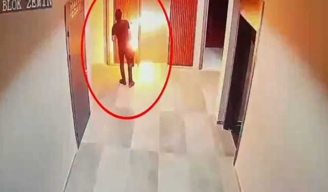 Dehşet Anı! Elektrikli Skuter Bataryası Elinde Patladı, 3 Parmağı Yanık
