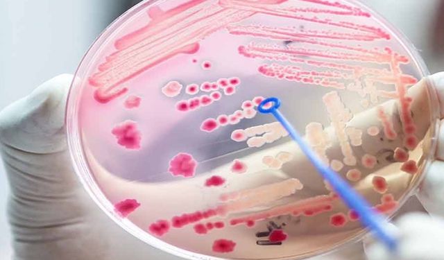 Her yıl 30 milyondan fazla insanı etkileyen Sepsis ölümle sonuçlanabiliyor