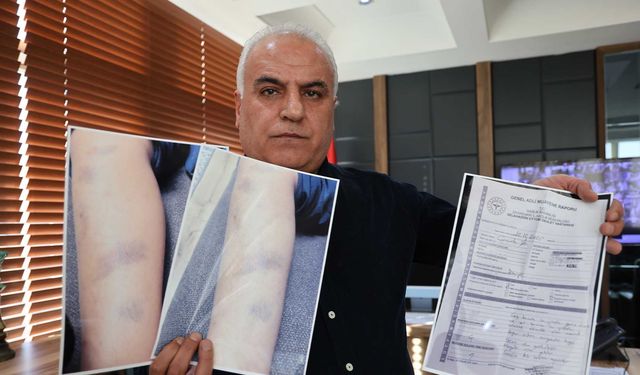 Özel okulda darp iddiası: 8 yaşındaki çocuk için suç duyurusu