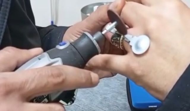 Parmağına sıkışan yüzüğü itfaiye çıkardı