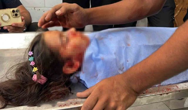 Gazze'de Can Kaybı Artıyor: Şehit Sayısı 73 Bin 39'a Yükseldi