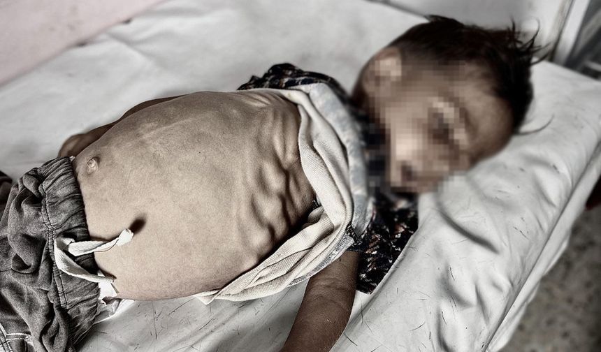 Gazze'de açlıktan ölümler artıyor: 2'si çocuk 4 kişi daha hayatını kaybetti