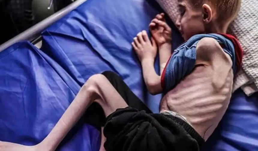 Gazze'de açlıktan ölenlerin sayısı giderek artıyor