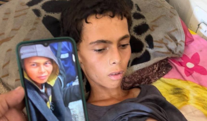 Gazze'de Kıtlık Bir Can Daha Aldı